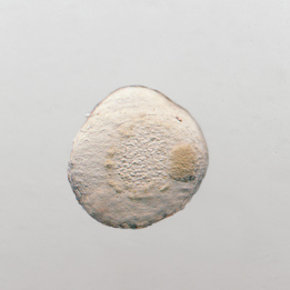 brightfield ofan embryo stereo discovery v12 3